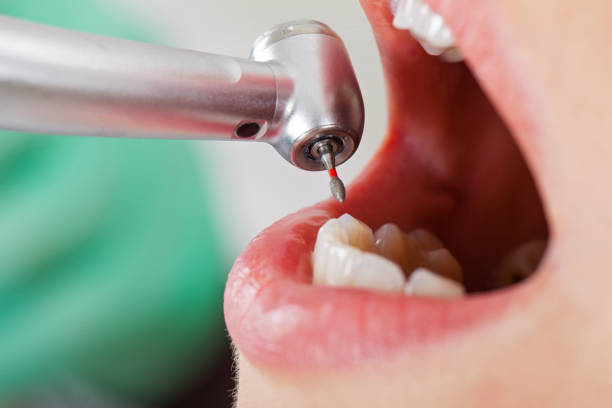 Best Pediatric Emergency Dentist in Broadview, IL